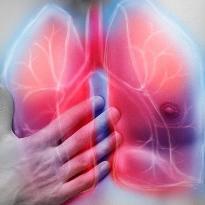 b embolie pulmonaire th