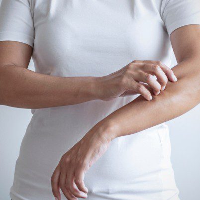 b visuel psoriasis 402
