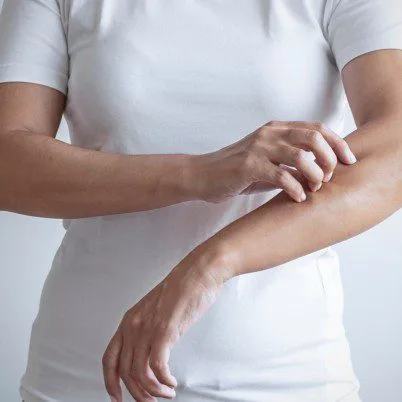 b visuel psoriasis 402